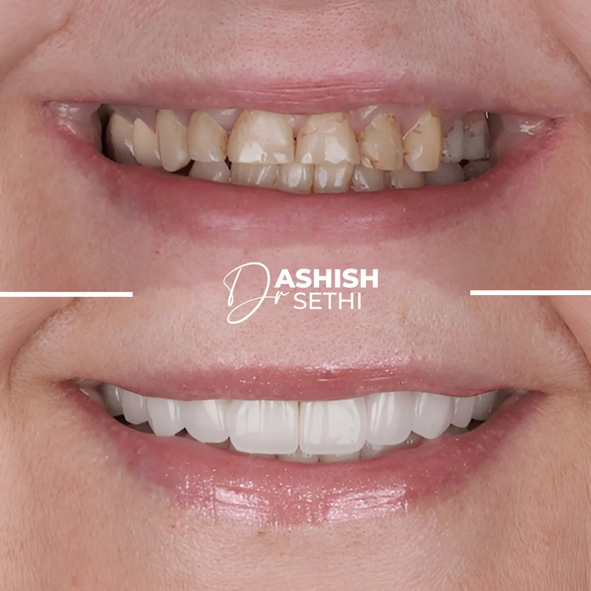 Before and After Transformation 2